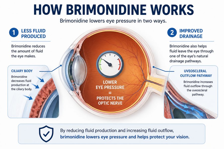 How brimonidine lowers eye pressure: less fluid produced and improved drainage