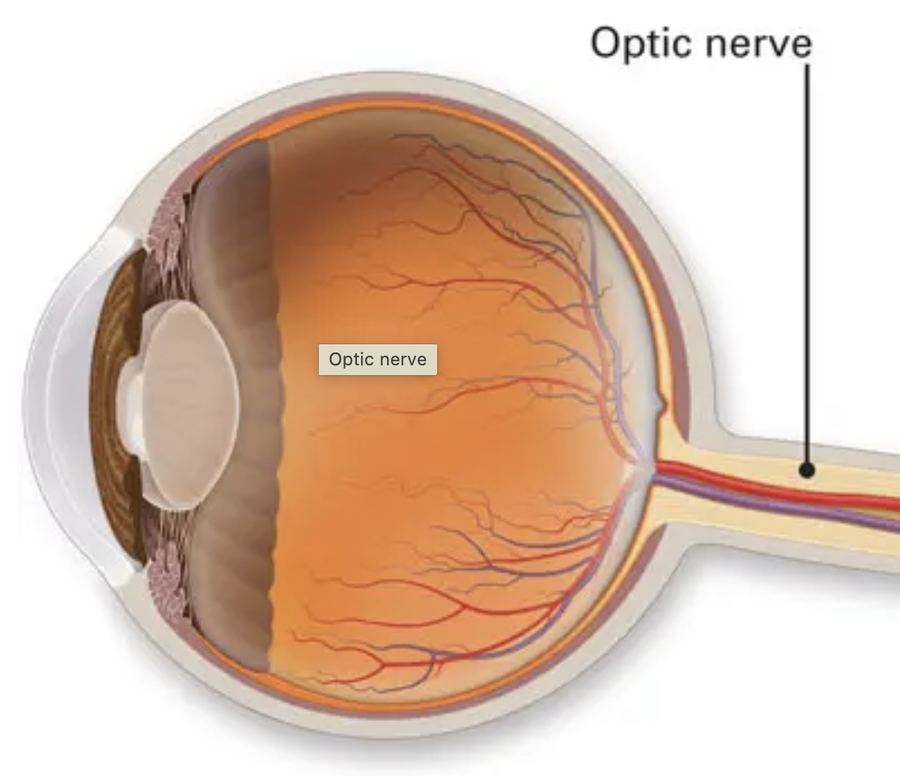 The optic nerve and how glaucoma damages it