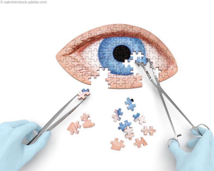 Solving the glaucoma puzzle: the 2026 glaucoma surgical pipeline