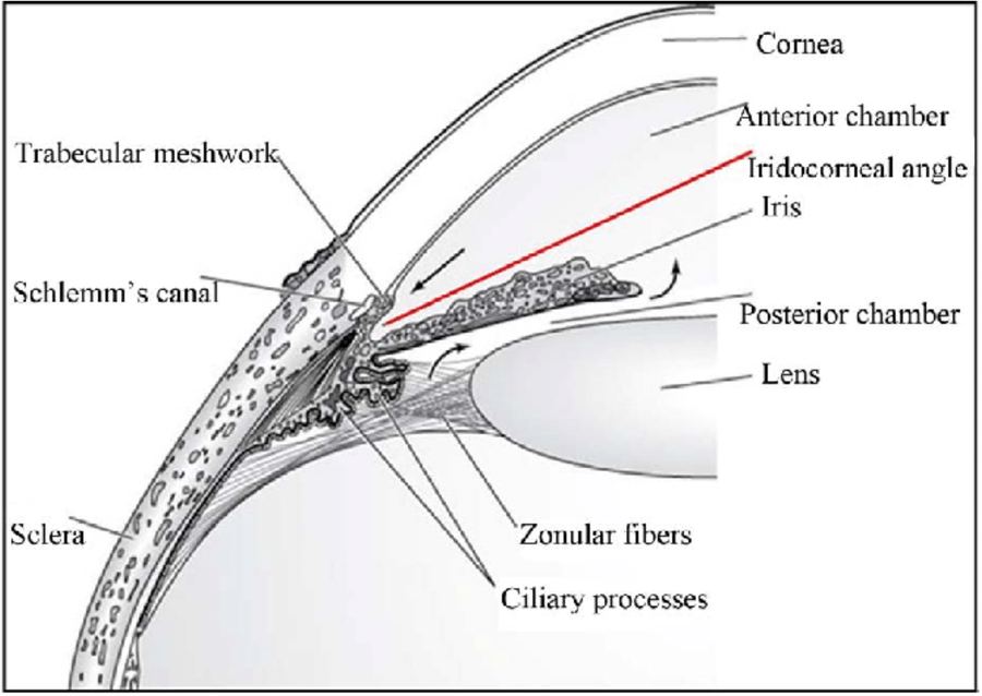 Trabecular micro-bypass stent for minimally invasive glaucoma surgery