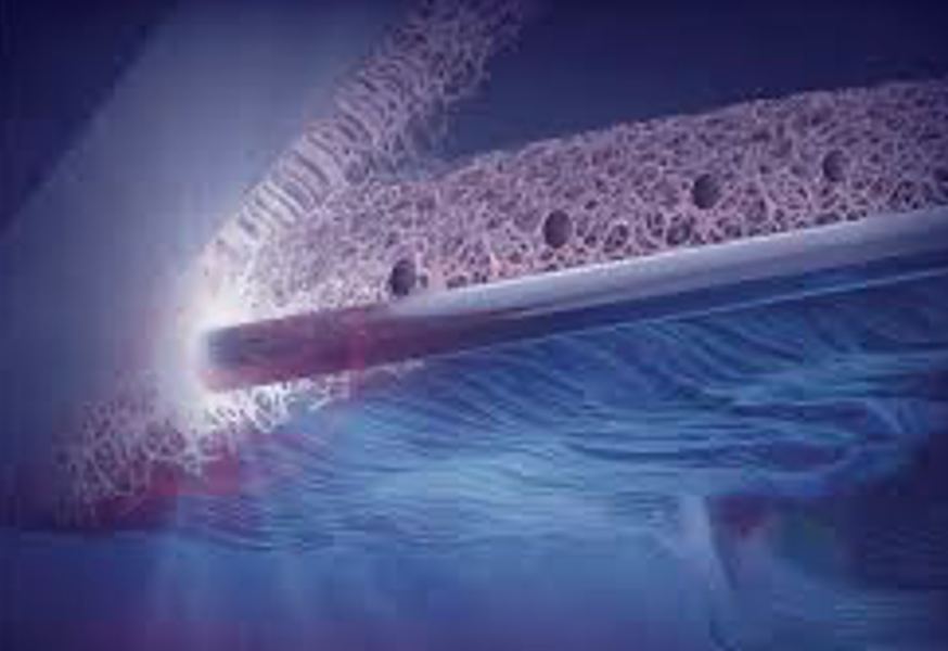Laser-based minimally invasive glaucoma surgery system