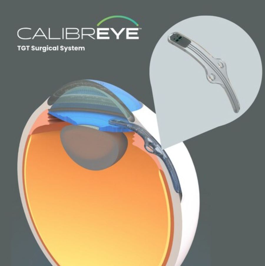 Emerging glaucoma surgical device in the 2026 pipeline