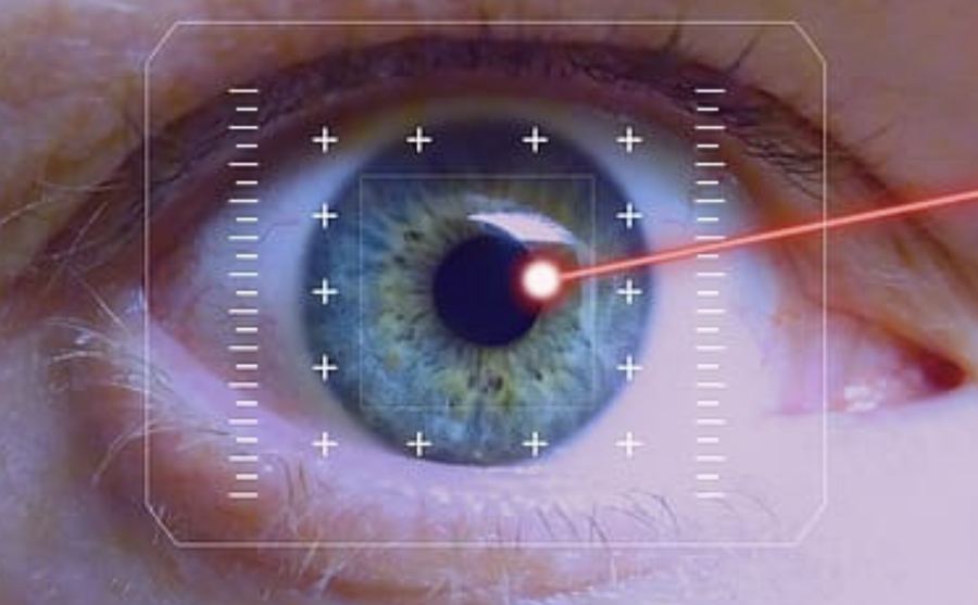 Laser treatment option for glaucoma