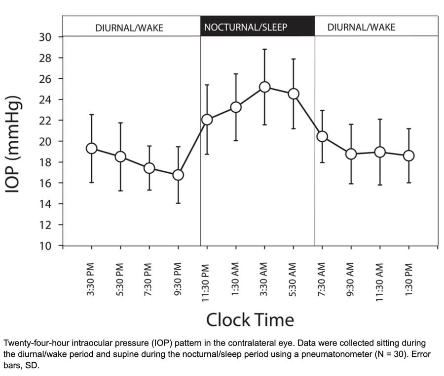 24-hour intraocular pressure pattern and eye-drop timing